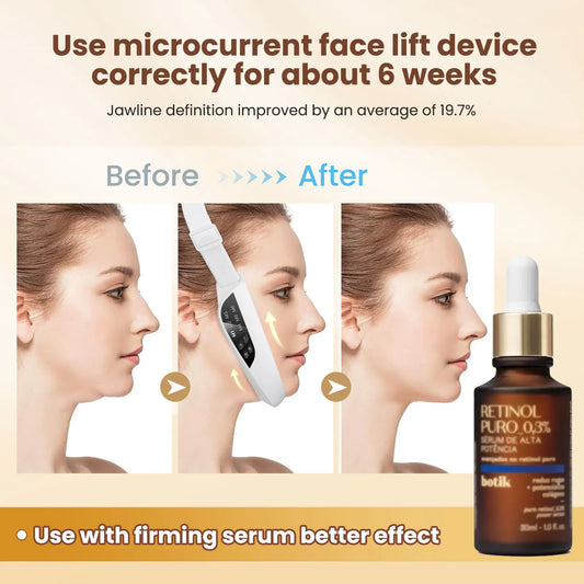 V-Face Lifting Beauty Tool